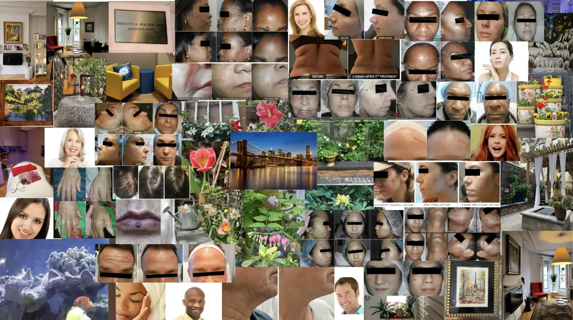 Mission statement surrounded by our collection of before, and after pictures that represents our Park slope dermatology office in Brooklyn